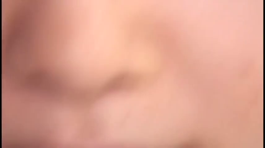 不明 · 不明 · 不明 · 不明 · 不明 · 局部皮肤 · 极度模糊